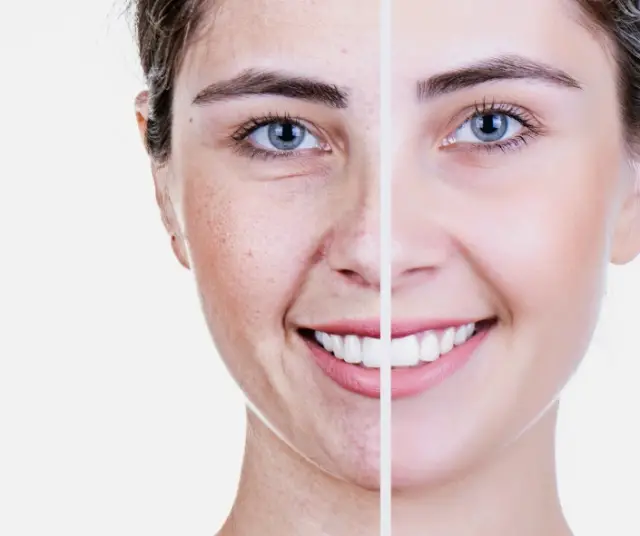 Comment rester jeune et en bonne santé