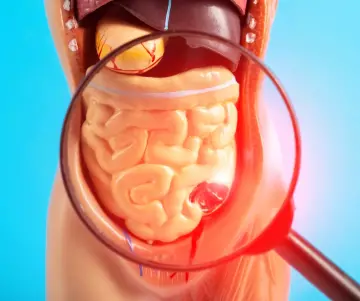 Comment se débarrasser des gaz ou des flatulences ?